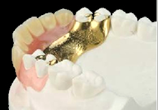 審美義歯（スマートデンチャー）　