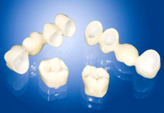 ジルコニア（冠）による補綴治療